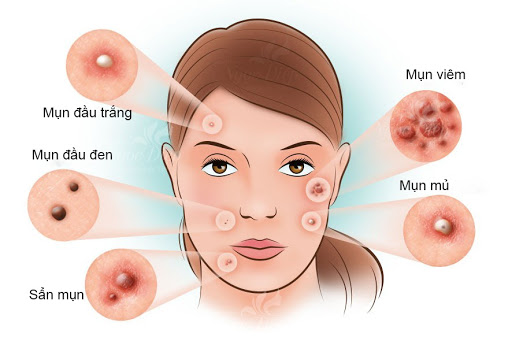 cach cham soc da mun hieu qua 2